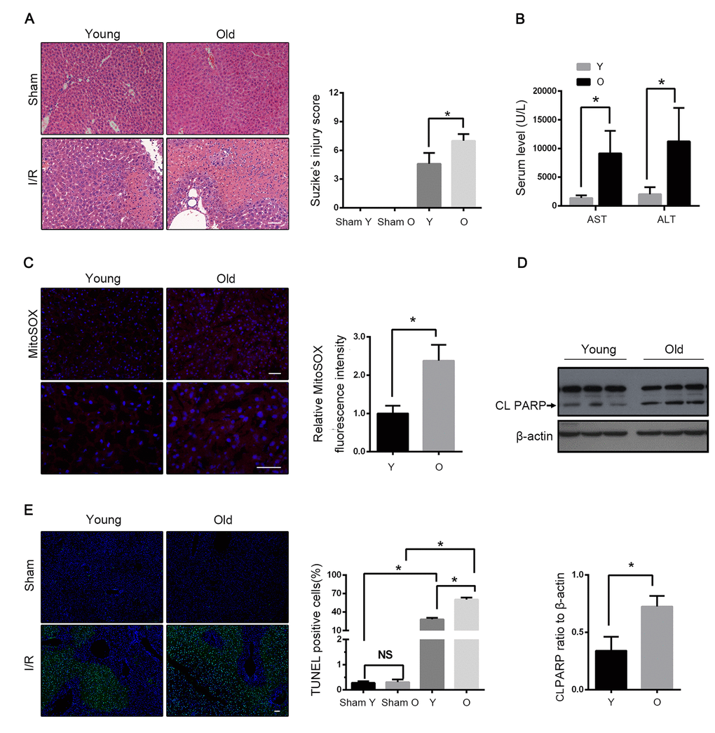 Aging aggravates hepatic I/R injury in C57BL/6 mice. Young (Y) and old mice (O) were subjected to middle and left hepatic pedicle occlusion for 1 h before reperfusion (I-R) or sham operation (Sham). Liver and blood were collected 1 h after reperfusion. (A) Representative histology of liver by H&E staining and pathological score of liver damage. (B) Blood samples were collected for measurements of serum AST and ALT. (C) Reactive oxygen species generated by mitochondria was detected by MitoSOX Red staining. (D) Whole tissue lysate of liver was collected for immunoblot analysis of cleaved PARP (CL PARP). (E) Representative images of TUNEL staining of liver tissues and quantification of TUNEL-positive cells rate in liver tissues. The data are expressed as mean ± SD. Statistical comparisons were performed with t-test. *P 