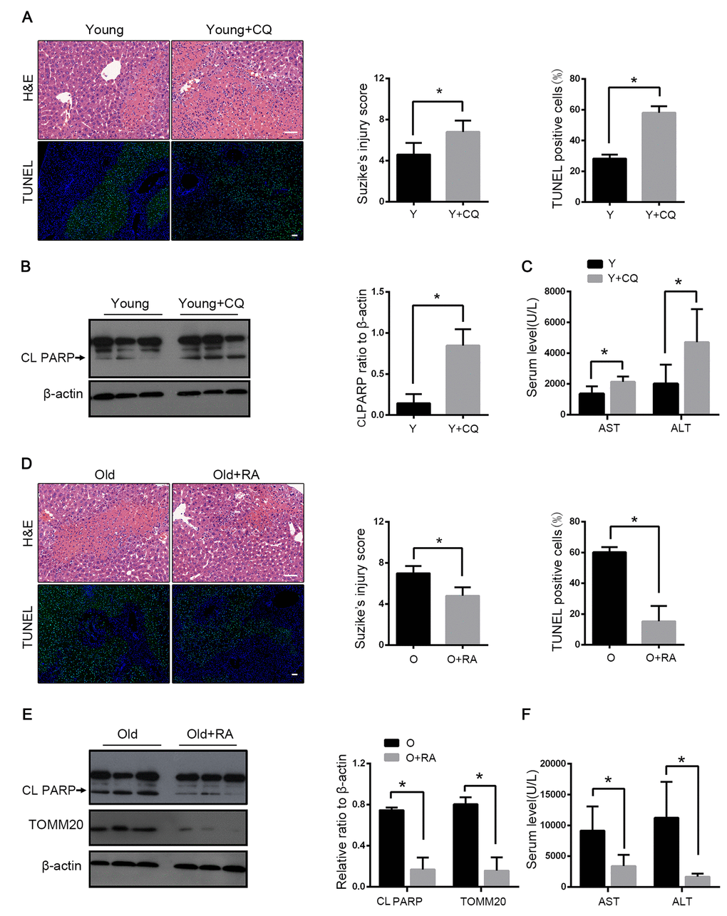 Mitophagy protects liver from I/R injury. Young mice with CQ pretreatment (Y+CQ) or without (Y) were treated as indicated. (A) Representative histology of liver by H&E staining (top panel) and pathological score of liver damage from indicated groups; TUNEL staining (bottom panel) and quantification of TUNEL-positive cells rate from indicated groups. (B) The cleaved PARP (CL PARP) protein levels were determined by western blot analysis from indicated groups. (C) Measurements of serum AST and ALT from indicated groups. Old mice with Rapamycin pretreatment (O+RA) or without (O) were treated as indicated. (D) Representative histology of liver by H&E staining (top panel) and pathological score of liver damage from indicated groups; TUNEL staining (bottom panel) and quantification of TUNEL-positive cells rate from indicated groups. (E) The cleaved PARP (CL PARP) and TOMM20 protein levels were determined by western blot analysis from indicated groups. (F) Measurements of serum AST and ALT from indicated groups. The data are expressed as mean ± SD. Statistical comparisons were performed with t-test. *P 