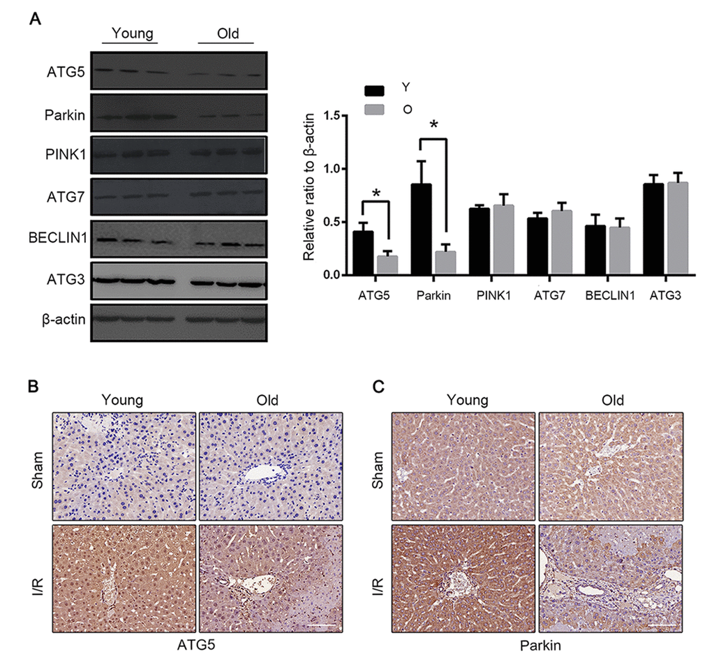 Parkin and Atg5 reduced in livers of old C57BL/6 mice during hepatic I/R. (A) The Atg5, Parkin, PINK1, Atg7, BECLIN1 and Atg3 protein levels were determined by western blot analysis from the liver tissue of young (Y) and old (O) mice. Representative images of Atg5 (B) and Parkin (C) staining of liver tissues by immunohistochemistry. The data are expressed as mean ± SD. Statistical comparisons were performed with t-test. *P 