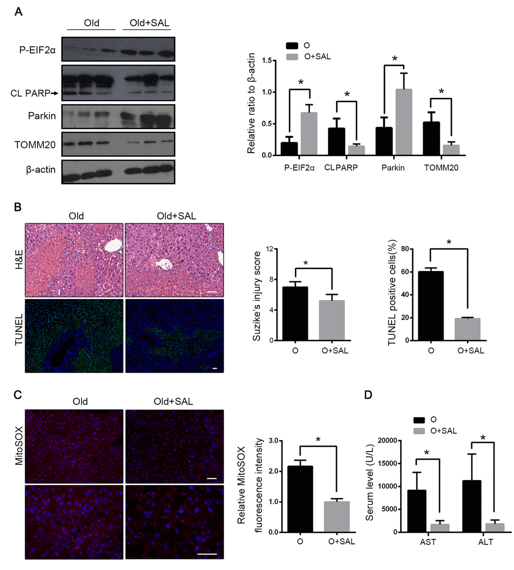 Salubrinal alleviated HIRI through phosphorylation of EIF2α. Old mice with Salubrinal pretreatment (O+SAL) or without (O) were treated as indicated. (A) The phosphorylated EIF2α, cleaved PARP (CL PARP), Parkin and TOMM20 protein levels were determined by western blot analysis from indicated mice. (B) Representative histology of liver by H&E staining (top panel) and TUNEL staining (bottom panel) from indicated groups. (C) Representative reactive oxygen species generation by MitoSOX Red staining and quantification of MitoSOX red fluorescence intensity. (D) Measurements of serum AST and ALT from indicated groups. The data are expressed as mean ± SD. Statistical comparisons were performed with t-test. *P 