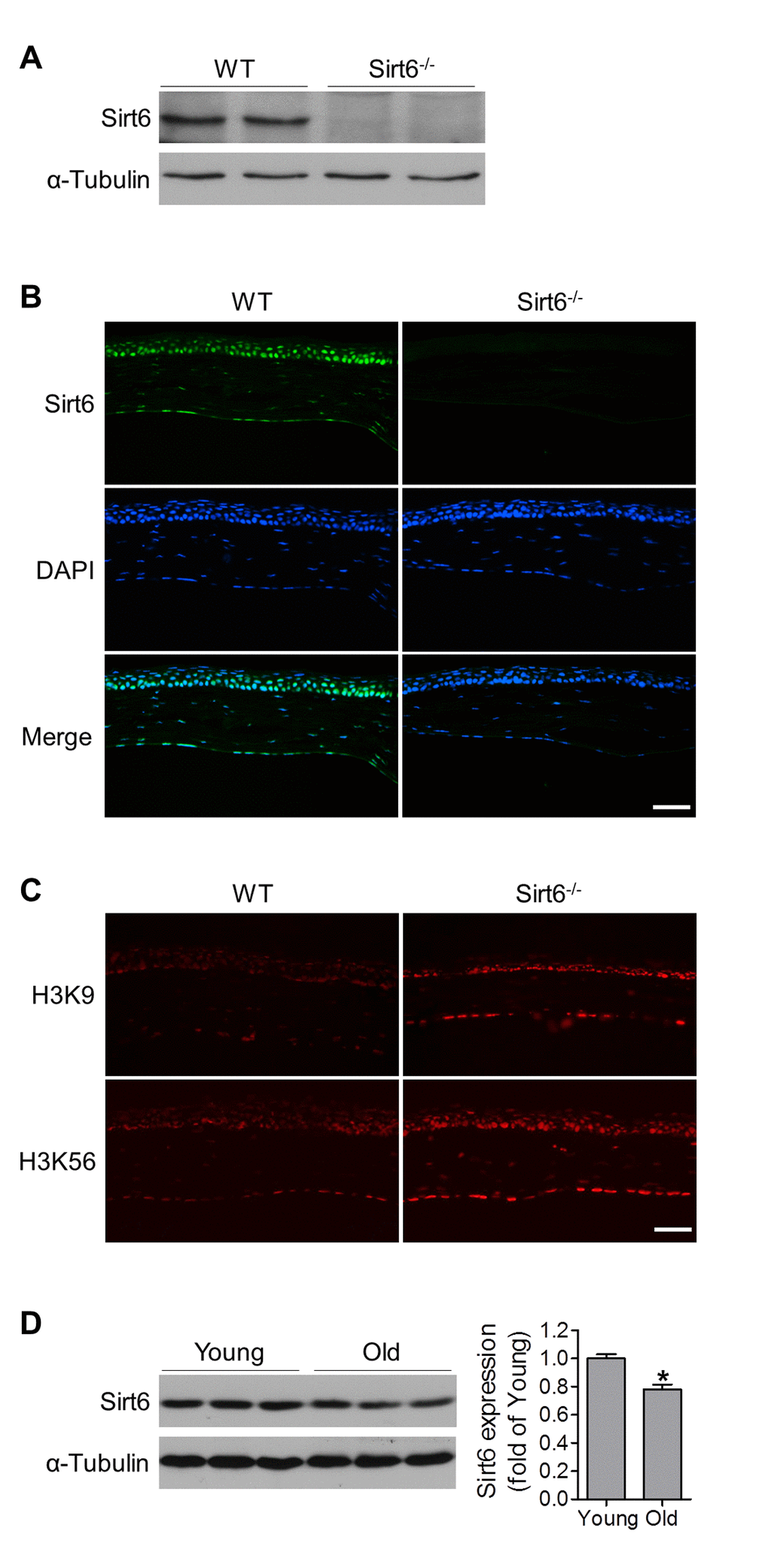 Functional Sirt6 is expressed in mouse cornea. (A) Protein was extracted from the corneas of WT and Sirt6-/- mice and Sirt6 protein expression was assessed by Western blot analysis. α-Tubulin served as loading control. (B, C) Immunostaining of Sirt6 (green), H3K9 and H3K56 (red) in corneal cryosections from 2 month-old WT and Sirt6 KO mice. Blue: DAPI staining for nuclei. Scale bar: 50μm. (D) Sirt6 protein expression in young (2 months old) and old (12 months old) mice cornea. Two corneas served as one specimen. *p