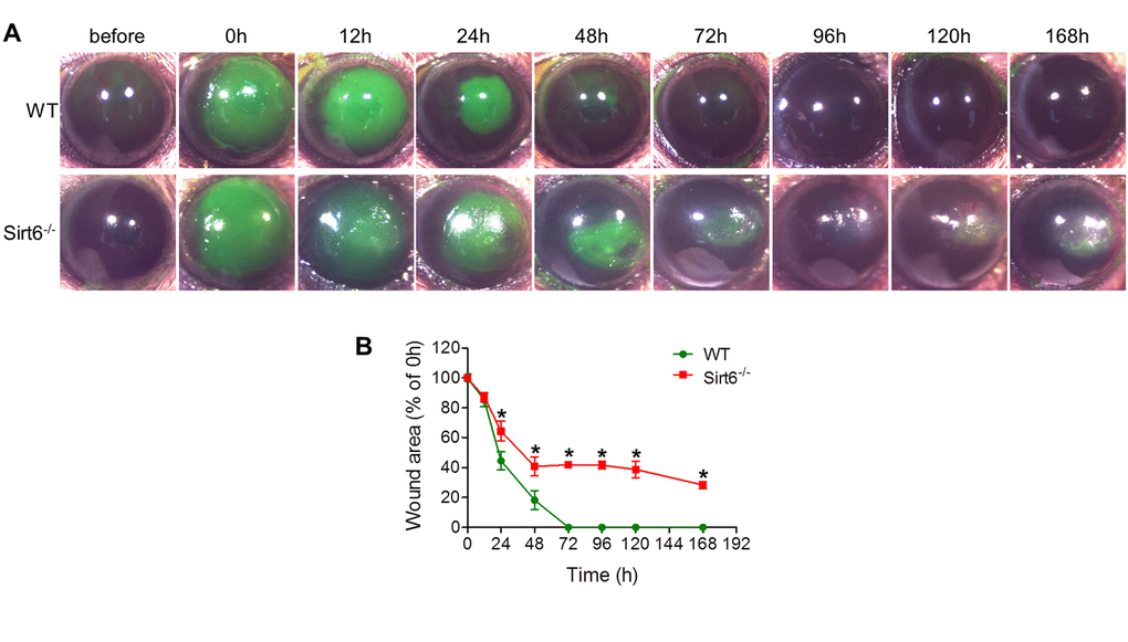 Corneal wound healing response in WT and Sirt6 KO mice. 2.0 mm central corneal epithelial debridement wounds were induced in 8-week-old WT and Sirt6 KO mice. (A) The corneas were photographed with fluorescein staining to visualize wounds before wounding or at various time points after wound injury. (B) The area of each epithelial defect was measured using ImageJ and the wound area was calculated as a percentage of the initial wound area. *p
