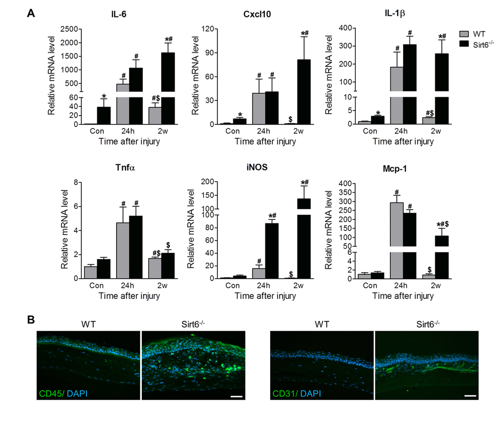 Sirt6 deletion results in corneal inflammation. 2.0 mm central corneal epithelial debridement wounds were induced in 8-week-old WT and Sirt6 KO mice and corneas were collected at indicated time pointes after injury. (A) Inflammatory genes were assessed by qPCR in WT and Sirt6 KO corneas before (control), 24 hours (24h) and 2 weeks (2w) after wound injury. *pB) Immunostaining for inflammatory cell marker CD45 and vascular cell marker CD31 (green) in WT and Sirt6 KO corneas 3 weeks after wound injury. Nuclei are counterstained with DAPI (blue). Scale bar: 50 μm.