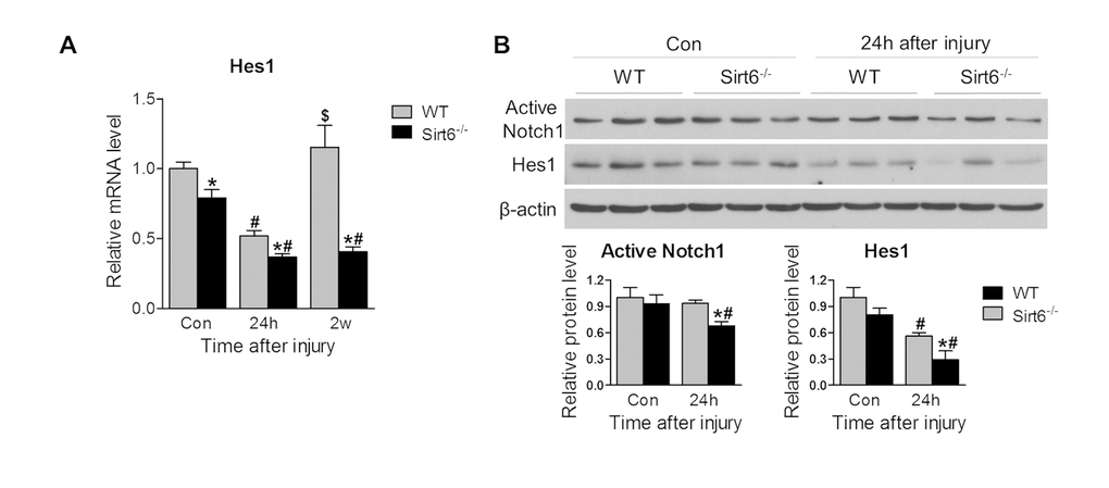 Sirt6 deletion impairs Notch signaling. 2.0 mm central corneal epithelial debridement wounds were induced in 8-week-old WT and Sirt6 KO mice and corneas were collected at indicated time points after injury. (A) Notch signaling downstream target Hes1 in the corneal was examined by qPCR in WT and Sirt6 KO corneas before injury (control), 24 hours (24h) and 2 weeks (2w) after injury. (B) Active Notch1 and Notch signaling downstream target Hes1 in the corneas were examined by Western blot in WT and Sirt6 KO corneas before or 24 hours after injury. *p