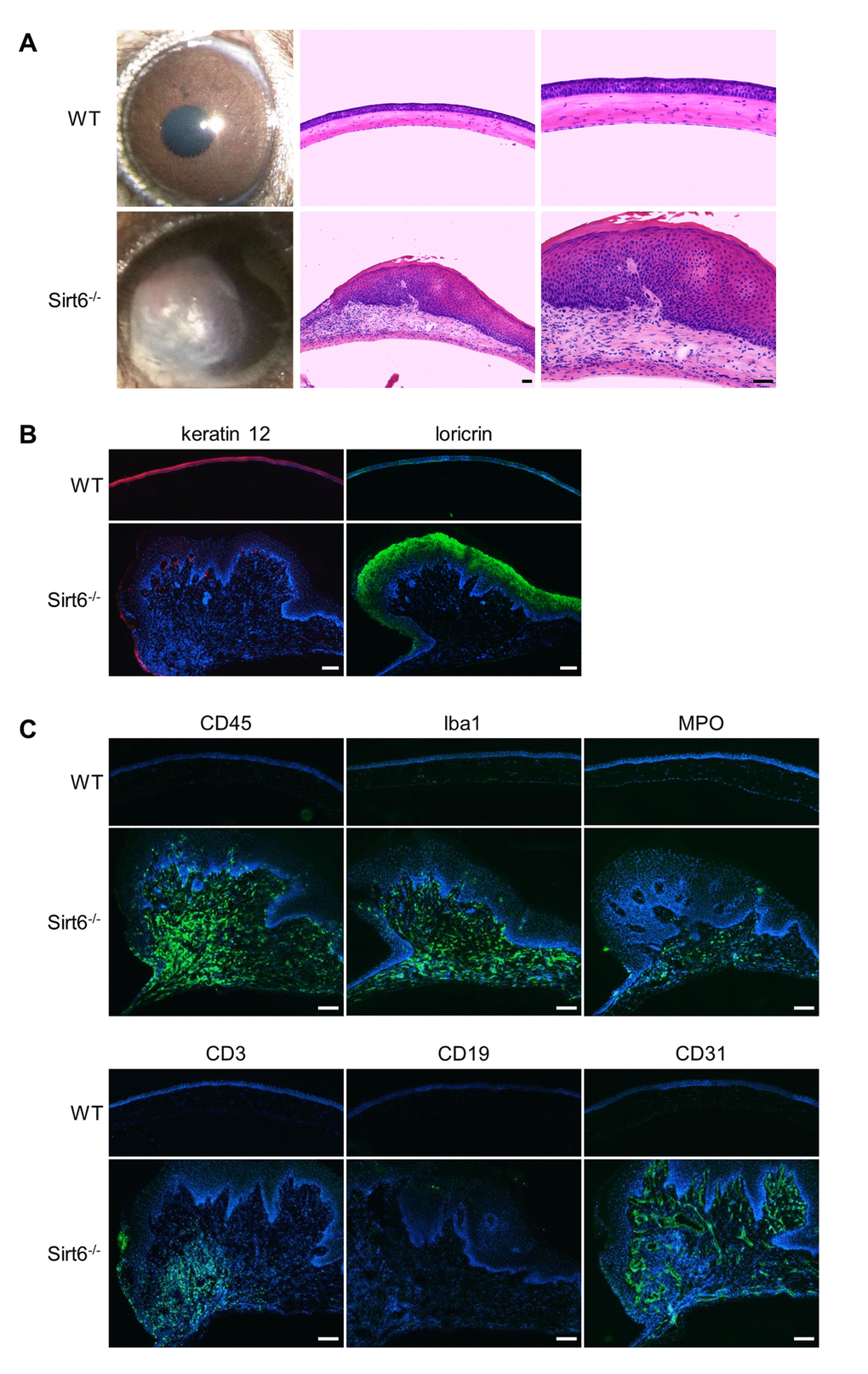 Sirt6-/- mice develop corneal plaques with infiltration of inflammatory cells and neovascularization as they age. Eyes were collected from 7-month-old Sirt6 KO mice and their littermate WT mice. (A) Images of the corneas and H&E staining of cross-sections of eyes from WT and Sirt6 KO mice (n=6 mice). Scale bar: 50 μm. (B) Immunostaining of keratin 12 (red) and loricin (green). Scale bar: 100 μm. (C) Immunostaining for hematopoietic cell markers such as CD45 for lymphoid cells (monocytes) (green), Iba1 for activated macrophages, MPO for neutrophils, CD3 for T cells, CD19 for B cells and CD31 for neovascularization in 7 month-old WT and Sirt6 KO corneas. Nuclei are counterstained with DAPI (blue). Scale bar: 100 μm.