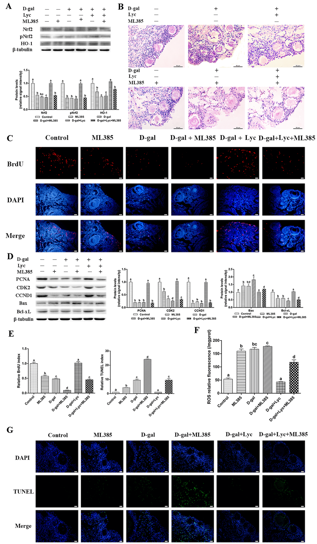 Protective effect of lycopene on the oxidative stress in the aging ovarian tissues was abolished by ML385. (A) Relative changes in the expression of Nrf2, pNrf2 and HO-1 after treatment with D-gal, ML385 alone or combined with lycopene. (B) Changes in the morphology of ovarian tissues after treatment with D-gal, ML385 alone or combined with lycopene, scale bar: 50 µm. (C and E) Changes in BrdU index in ovarian tissues after treatment with D-gal, ML385 alone or combined with lycopene, scale bar: 20 µm. (D) Relative changes in the expression of proteins related to cell proliferation and cell apoptosis in ovarian tissues after treatment with D-gal, ML385 alone or combined with lycopene. (E and G) Changes in TUNEL index in ovarian tissues after treatment with D-gal, ML385 alone or combined with lycopene, scale bar: 20 µm. (F) Changes in the levels of ROS in ovarian tissues after treatment with D-gal, ML385 alone or combined with lycopene. Values are expressed as the means±s.e.. Different lowercase letters indicate significant differences (P 