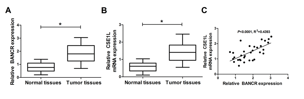 BANCR and CSE1L were highly expressed in CRC tumor tissues. (A and B) Expressions of BANCR and CSE1L in 32 pairs of CRC tumor tissues and adjacent normal tissues. (C) Correlation analyses of BANCR and CSE1L expressions in CRC tumor tissues (n=21). *P 