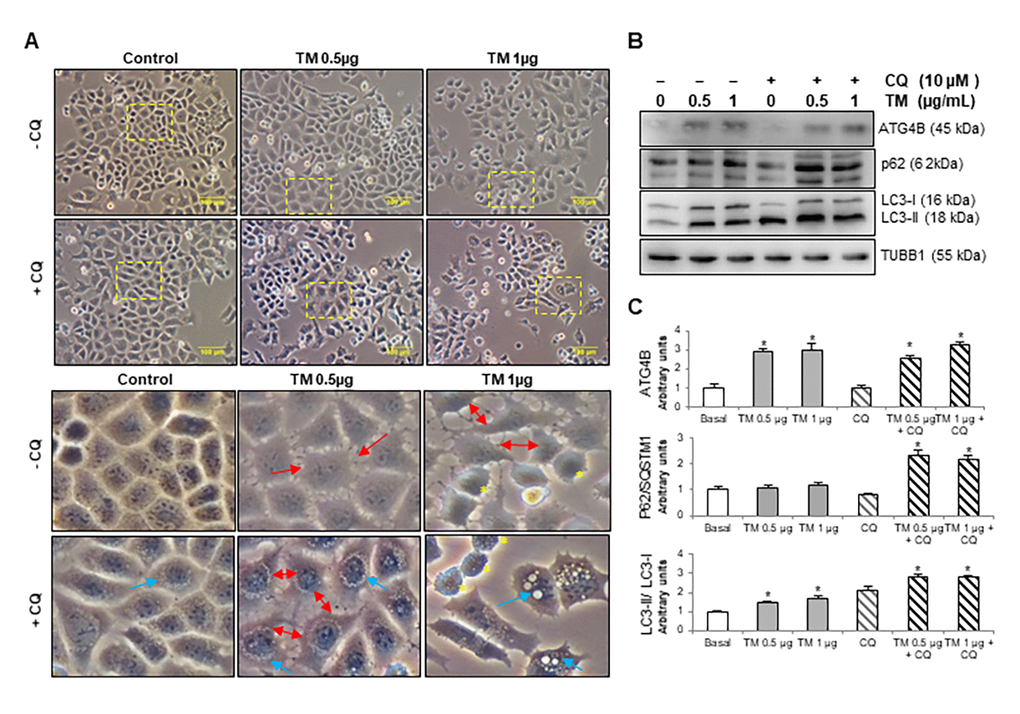 Tunicamycin induces changes in cell morphology, ATG4B expression and autophagy activation in MLE12 cells. (A) Phase contrast images of mouse epithelial MLE12 cells treated with vehicle control or 0.5 and 1 μg/ml tunicamycin alone or in combination with chloroquine for 24h. The line scale bar represents 100 μm. Lower panels represent magnified pictures of boxed area in the corresponding upper panels. Red arrows point out loss of cell-cell contacts, blue arrows indicate accumulation of vacuoles in cytoplasm and yellow asterisk point out apoptotic-like cells. (B) Representative immunoblots of ATG4B, LC3-I/ II, and p62 in mouse alveolar epithelial MLE12 cells treated with vehicle control or 0.5 and 1 μg/ml tunicamycin alone or in combination with chloroquine for 24h. β-tubulin was used as loading control. (C) Densitometry. Protein levels were normalized to vehicle control. Results represent mean ± SD. Statistical significance was determined by one-way ANOVA (* p