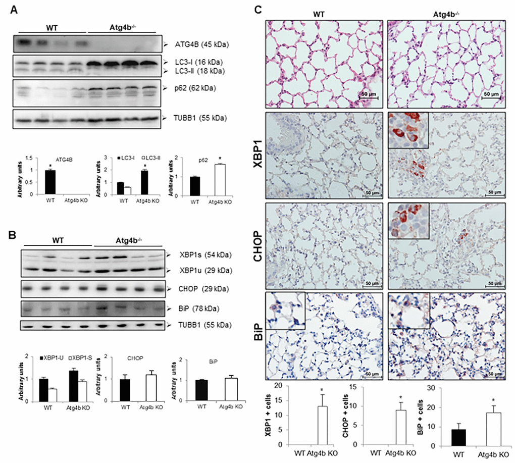 Loss of autophagy function by Atg4b deficiency resulted in mild ER stress induction. (A) Representative immunoblots of ATG4B, LC3-I/ II, and p62 in lung tissue from WT and Atg4b null mice in basal conditions. (B) Representative immunoblots of ER stress biomarkers in lung tissue from WT and Atg4b null mice in basal conditions. β-tubulin was used as loading control. Densitometry analysis (bottom panels). (C) Representative photomicrographs of immunohistochemical staining performed with specific primary antibodies against XBP1, CHOP and BiP in lung tissues sections from WT and Atg4b in unchallenged/basal conditions. Positive signal is observed in red. All sections were counterstained with hematoxylin. All insets show 2X larger magnification. Total number of positive stained cells per high power field (40X) in lung tissue sections by quantitative image analysis. Results are shown as mean ± SD. Statistical significance was determined by Student´s t-test (*p 