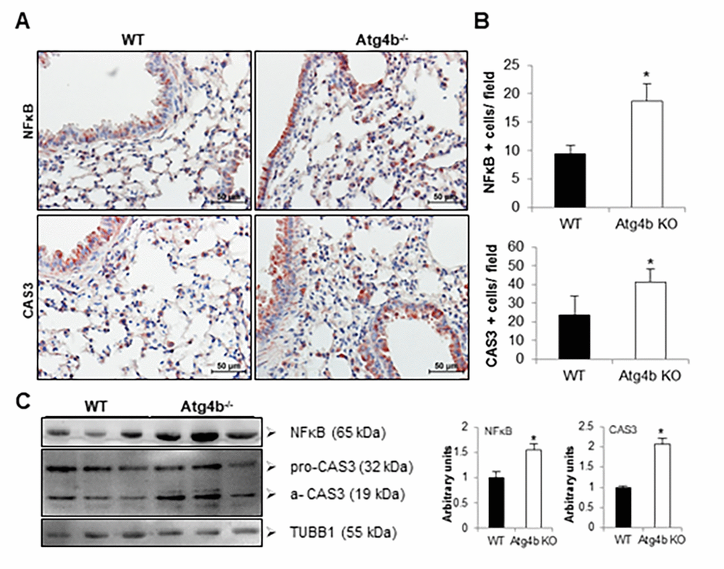 Atg4b deficiency resulted in increased NFκB and CAS3 expression in mouse lung at 3 days after tunicamycin administration. (A) Representative photomicrographs of immunohistochemical staining performed with specific primary antibodies against NFκB and CAS3 in lung tissues sections from WT and Atg4b tunicamycin-treated mice at 3 days post-instillation. Positive signal is observed in red. All sections were counterstained with hematoxylin. (B) Total number of positive stained cells per high power field (40X) in lung tissue sections by quantitative image analysis. (C) Representative immunoblots of NFκB and CAS3 in lung tissue from WT and Atg4b null mice at 3 days post-tunicamycin instillation (left panel) and densitometry analysis (right panel). Results are shown as mean ± SD. Statistical significance was determined by Student´s t-test (*p 