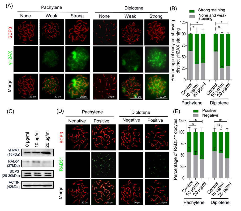 nZnO induces DNA damage in fetal oocytes in vitro. (A) Representative double IF of pachytene and diplotene oocytes for SCP3 (red) and γH2AX (green) obtained from ovarian tissues cultured for 6 days. (B) Quantification of oocytes showing distinct γH2AX staining. (C) Representative WB for the indicated proteins from ovarian tissues cultured for 6 days; actin was used as loading control. (D) Representative double IF of pachytene and diplotene oocytes for SCP3 (red) and RAD51 (green). (E) Quantification of oocytes showing RAD51 foci.