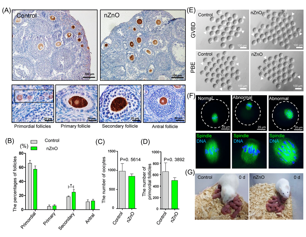 nZnO expose alters follicle dynamics in 21 dpp ovaries. (A) Identification of different type of follicles with immunohistochemistry of MVH positive oocytes in 21 dpp ovaries. (B) Percentage of different type of follicles in the same ovaries of (A). (C-D) Number of oocytes and PFs in the same ovaries of (A). (E) Representative images of GVBD and PBE. (F) Meiotic spindle morphologies in MI oocytes. (G) Representative morphologies of second filial generation.