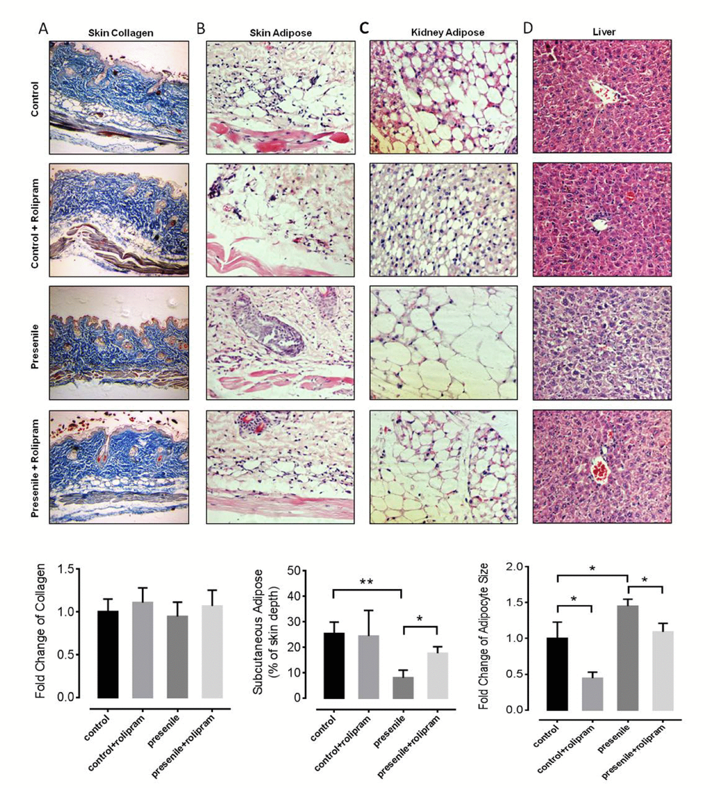 Rolipram improves adipose distribution in presenile mice. (A) Masson’s trichrome staining of the skin of mice with or without rolipram treatment. The blue staining shows the collagen content (original magnification: 10x in both images). (B-D) Hematoxylin and eosin staining of the skin (B), kidney adipose (C) and liver tissue (D) in mice with or without rolipram treatment. The unstained vacuoles are the adipose tissue (original magnification: 40x in both images).