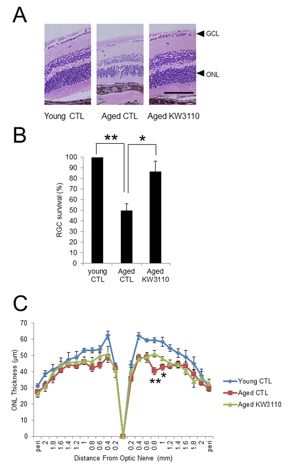 Protective effect of Lactobacillus paracasei KW3110 on age-induced histological changes and ganglion cell loss in the retina. (A) Hematoxylin and eosin staining of retinal sections in young mouse (3-months-old) fed a control (CTL) diet and aged mice (22-months-old) fed a diet either with or without L. paracasei KW3110 (KW3110 diet). Arrow heads indicate the ganglion cell layer (GCL) and outer nuclear layer (ONL), respectively. Scale bar represents 100 μm. (B) The survival rate of retinal ganglion cells (RGCs) in aged mice (22-months-old) fed a diet either with or without L. paracasei KW3110 (KW3110 diet) were analyzed compared to the survival of RGCs in young mice (3-months-old) fed a control diet. Values are presented as the means ± SEM. Significance was assumed if the p value was **p C) ONL thickness was lower in aged mice (22-months-old) fed control diet than in aged mice fed a diet with L. paracasei KW3110. Values are presented as the means ± SEM. Significance was assumed if the p value was *p **p 