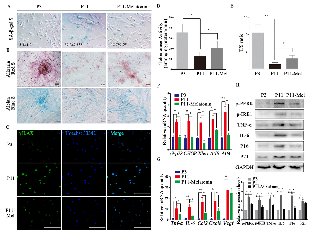 Melatonin attenuates ERS and SASP in cADMSCs. (A) SA-β-gal S of cADMSCs. (P3, 3rd passage, P11, 11th passage, P11–melatonin, melatonin-treated 11th passage) bar = 100 μm. (B) Alizarin Red and alcian blue staining of osteogenic and chondrogenic differentiation of cADMSCs. bar = 50 μm. (C) Immunocytochemistry of γH2AX in cADMSCs. bar = 200 μm. (D) Telomerase activity of cADMSCs. (E) Relative telomere length of cADMSCs. (F) Relative levels of SASP-related transcripts in cADMSCs. (G) Relative levels of ERS-related transcripts in cADMSCs. (H) Western blot quantification of ERS-related proteins (p-PERK and p-IRE1), SASP-related proteins (TNF-a and IL6), and senescent markers (P16 and P21).