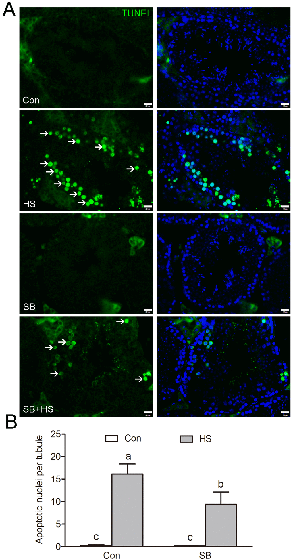 GSK3α inhibition is required for apoptotic GCs clearance. (A) Apoptotic cells revealed by TUNEL assay on testis sections. Representative seminiferous tubules are shown. The green signal (arrow) indicates a TUNEL-positive nucleus. Con: control; HS: heat shock; SB: SB216763. Scale bar=20 μm. (B) Histogram showing the average number of TUNEL-positive cells per seminiferous tubule. Values are expressed as the mean ± SEM, n=15. Values with different superscripts are significantly different from each other (P