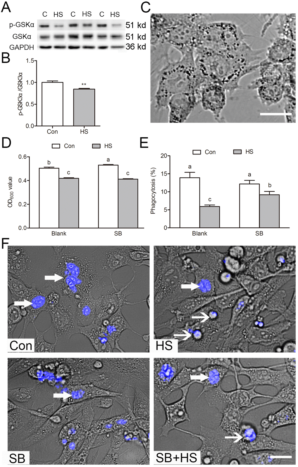 GSK3α participates in Sertoli cell phagocytosis of apoptotic germ cells. (A-B) Western blots and histogram showing the protein levels of GSK3α and p-GSK3α in control and HS treated TM4 cells. C: control; HS: heat shock. (C) The phagocytosis of Indian ink beads by TM4 cells observed by light microscopy. Black dots indicate engulfed Indian ink in TM4 cells. (D) Quantification of Indian ink beads phagocytosis via Micro plate spectrophotometer read as an OD value. (E) Histogram showing percentage of TM4 cells engulfing apoptotic germ cells as derived from immunofluorescence analysis. (F) Immunofluorescence analysis showing phagocytosis of apoptotic germ cells by TM4 cells treated with HS or GSK3α inhibitor. TM4 cells were fed with apoptotic male germ cells labeled with DAPI. Con: control, HS: heat shock, SB: SB216763. Thick arrow indicates engulfed germ cells. Thin arrow indicates unengulfed germ cells. Scale bars=10 μm. Values are expressed as the mean±SEM, n=15. Values with different superscripts are significantly different from each other (P