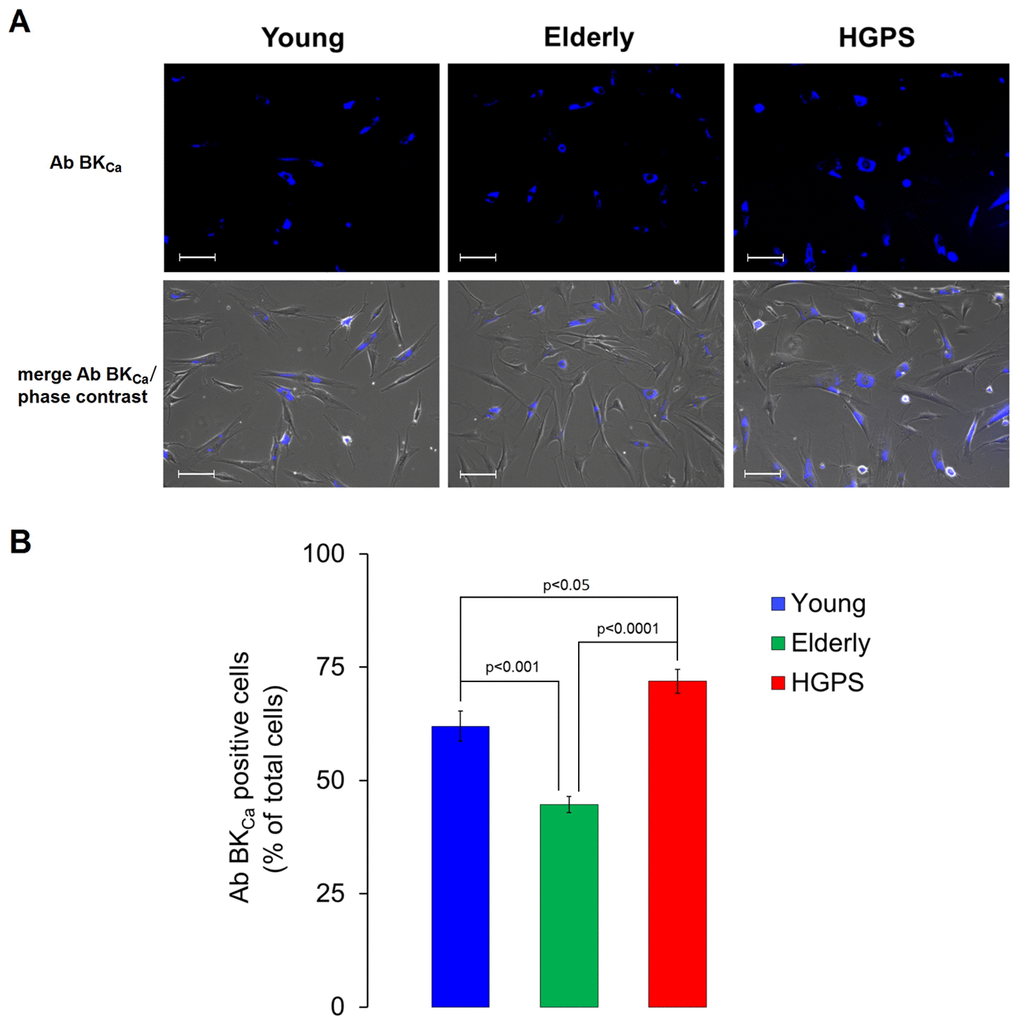 Immunofluorescence detection for BKCa channels expressed on plasma membrane in living cells. (A) Fluorescence and fluorescence/phase contrast merged micrographs of isolated hDF obtained from young, elderly and HGPS donors incubated with an anti-BKCa α subunit primary antibody visualized by the conjugated Alexa Fluor 350 fluorophore and acquired at 200× magnification. Scale bars: 100 μm. (B) Histogram showing the percentage of cells expressing a blue fluorescence intensity over a fixed threshold (% ± SEM). Significant differences calculated according to the Student’s t-test (p