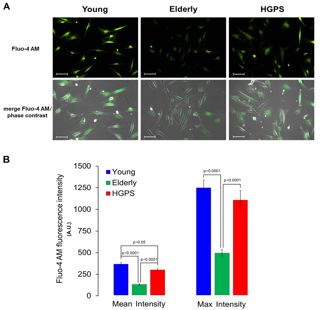 Detection of calcium concentration by fluorescence in living cells. (A) Fluorescence and fluorescence/phase contrast merged micrographs of isolated hDF obtained from young, elderly and HGPS donors incubated with the cell-permeant Ca2+ indicator Fluo-4 AM (2 μM) and at 200× magnification. Scale bars: 100 μm. (B) Quantification of Mean and Max fluorescence intensity (A.U. ± SEM). Significant differences calculated according to the Student’s t-test (p