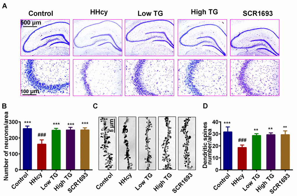 Supplementation with TG recovered dendritic spine and neuronal loss. After two weeks of Hcy (400 µg/kg/day) and two weeks TG treatment post-injection, the rats were sacrificed following behavioral test. (A and B) Representative Nissl staining images and the quantification of neuronal density, chart bar = 500 and 100 µm for low and high magnifications respectively. (C and D) Representative Golgi staining images and quantification of dendritic spines from randomly selected dendritic segments of randomly selected hippocampal neurons, chat bar = 5µm. HHcy animals showed neurodegeneration which was recovered following supplementation with both low and high TG doses. The data were expressed as mean ± SEM and n = 3 for both Nissl and Golgi staining. ### P 