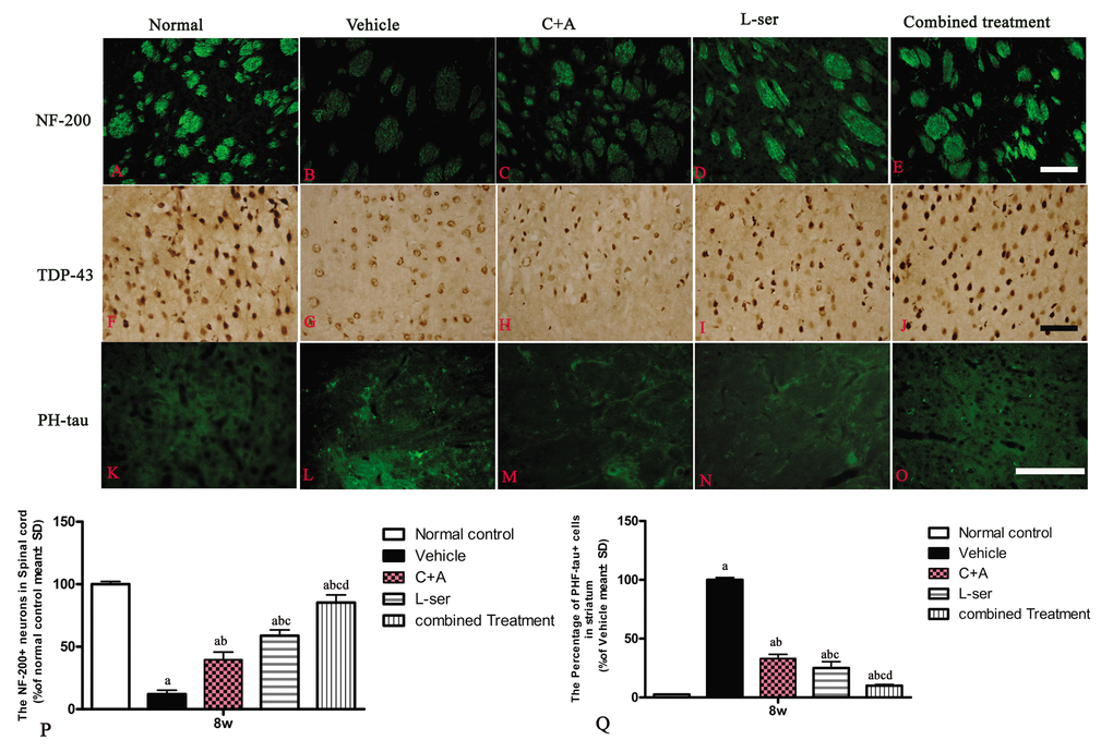 At 8 weeks post-injection, neurofilament disintegration and axonal destruction were found in basal ganglia of vehicle-treated group (B) in contrast with the normal control. At the same time point, intracellular movement of cytosolic TDP-43 protein (G) and high expression of hyper-phosphorylated tau (L) were detected in the striatum of the vehicle-treated group, while the C+A (C, H, M) and L-ser treatment (D, I, N) both were found to alleviate these effects in some extent, with the combined treatment (E, J, O) producing the best effects. (P, Q) Quantification of relative fluorescence of NF-200 (P) and PHF-tau (Q) staining in cells. (a) p