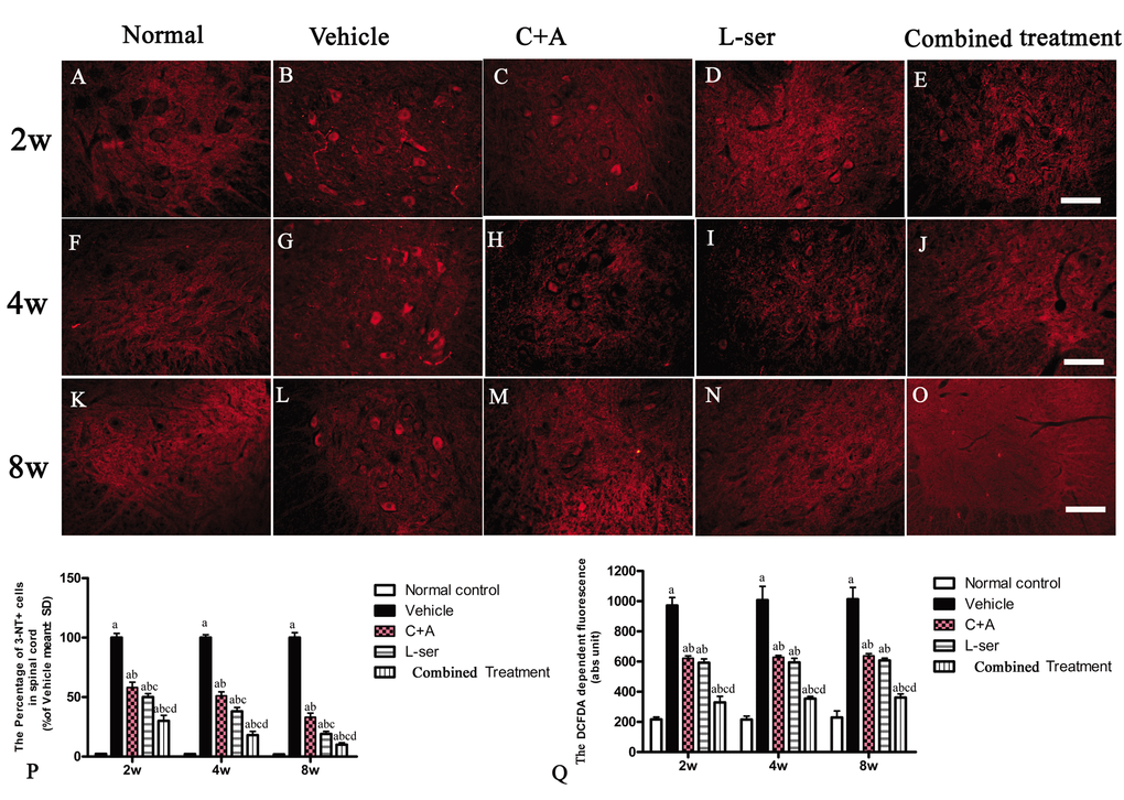 Immunostaining of 3-NT in lumbar spinal cord sections. The clear increase in 3-NT staining in spinal cord sections from the vehicle-treated rats from 2–8 weeks post-L-BMAA injection was clearly reduced by C16+Ang1 and L-serine treatment, and the combined treatment produced the most significant effects as revealed by cell quantification (P). (Q) ROS production. The amount of ROS produced in the vehicle-treated model group was significantly greater than the levels in the other groups. C16+Ang-1 and L-serine treatments, individually, reduced the ROS level, and the combined treatment led to the lowest ROS level among all the treated groups. (a) p(b) p