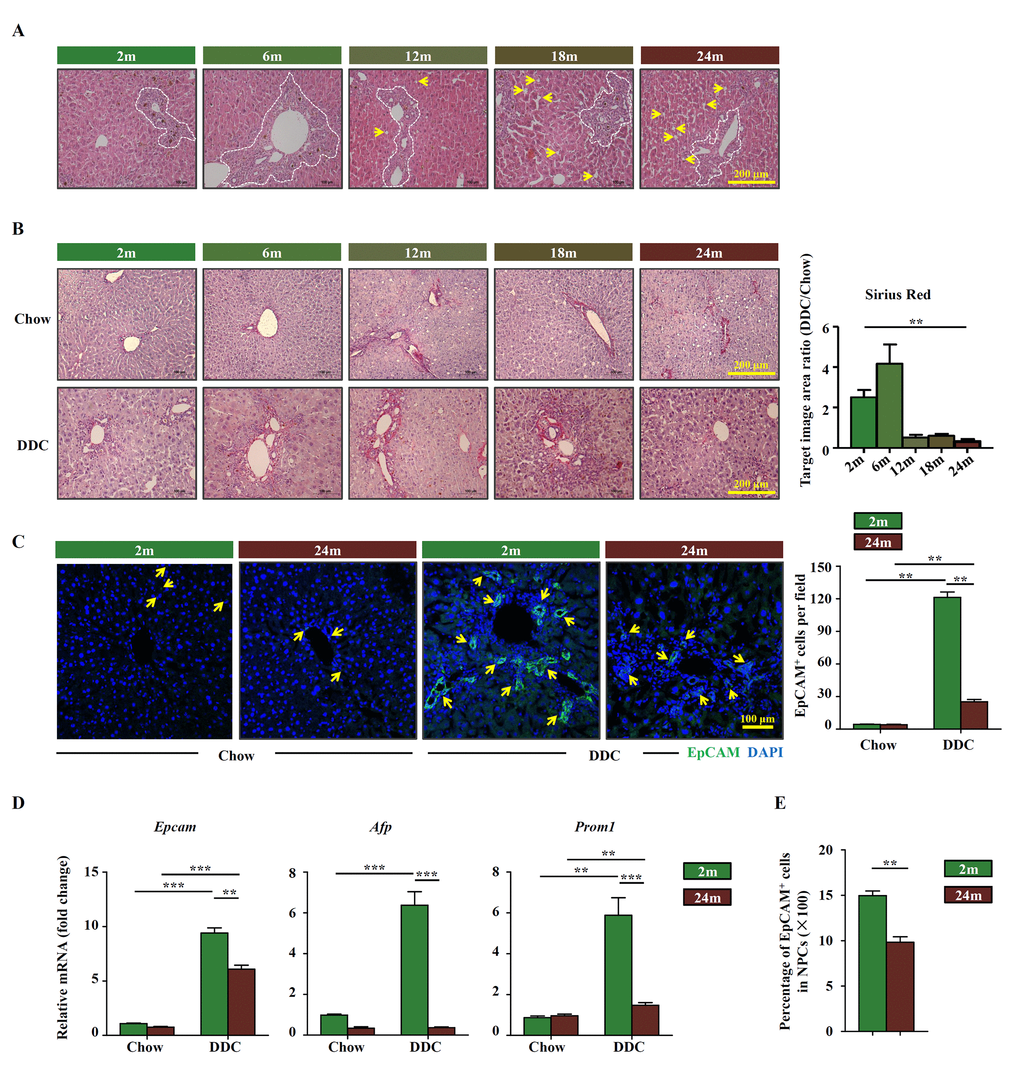 OC activation is impaired in aged mice. (A) H&E staining of DDC-fed mouse liver with the age of 2m, 6m, 12m, 18m and 24m (Scale bar=200 μm). The ductular reaction was shown in the white dashed lines outlined regions. Arrows indicated the hepatocyte steatosis. (B) Sirius red staining of the chow (Chow) and DDC groups (DDC) with the age of 2m, 6m, 12m, 18m and 24m (Scale bar=200 μm). The ratio of Sirius red staining area of DDC and chow groups was quantified (n=6, ** p C) Immunofluorescence staining for EpCAM+ cells (green) in DDC-fed (DDC) versus chow controls (Chow). Quantification of EpCAM+ cells was shown (n=6, ** p D) Quantitative Real-time PCR analysis of Epcam, Afp and Prom1 in young and aged DDC-fed mice liver (n=9, ** p E) EpCAM+ cells and NPCs were isolated from whole liver of DDC-fed young and aged mice, the ratio of EpCAM+ cells in NPCs was quantified (n=6, ** p 