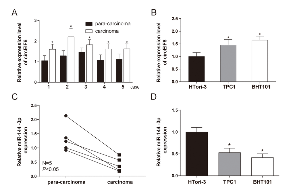 High level of circEIF6 and low level of miR-144-3p were found in 5 paired anaplastic thyroid carcinoma clinical specimens and thyroid carcinoma cells. (A and C) Highly expressed circEIF6 and lowly expressed miR-144-3p in anaplastic thyroid carcinoma tissues were displayed by qRT-PCR. *P B and D) High level of circEIF6 and low level of miR-144-3p were also observed in papillary thyroid carcinoma cells (TPC1) and anaplastic thyroid carcinoma cells (BHT101). *P 