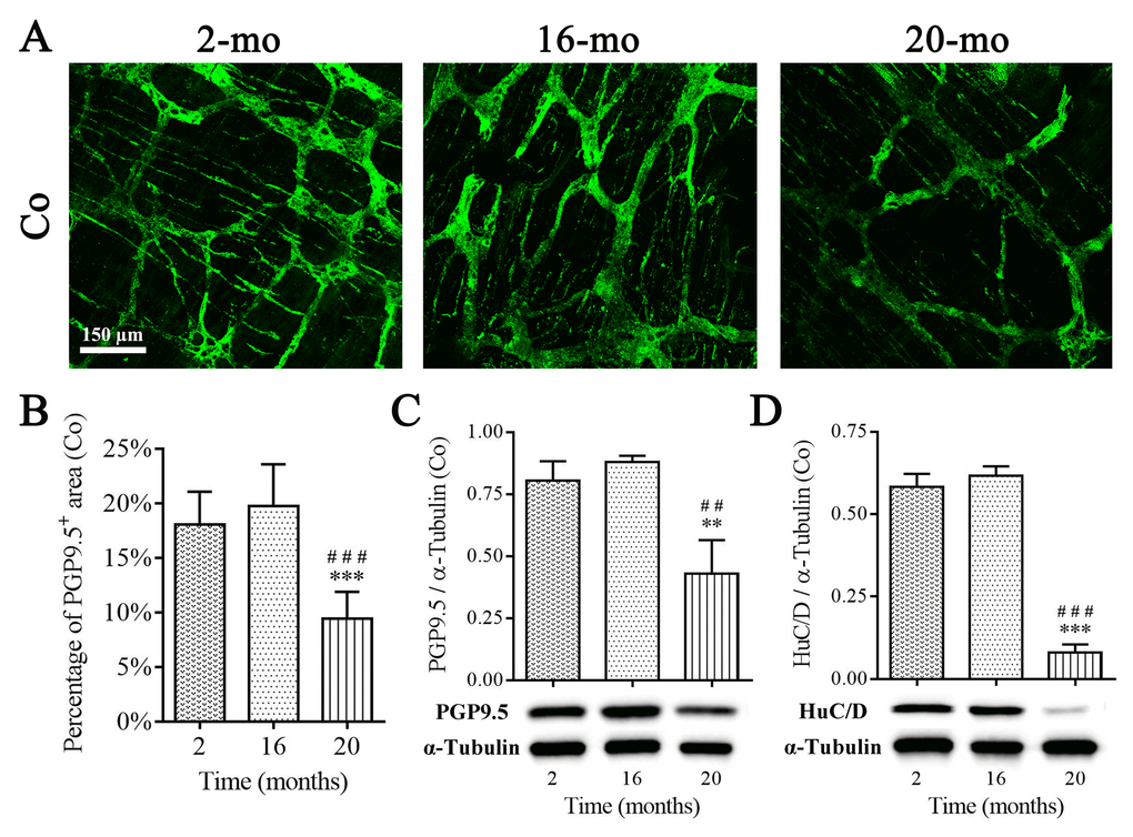 Diminished enteric neurons in the colon of old mice. PGP9.5 recognized perikarya and nerve fibers within MP, and PGP9.5-positive area per field in 20-mo-old mice were significantly declined compared with 2- and 16-mo-old mice (A-B). The reduction in protein expression of PGP9.5 (C) and HuC/D (D) was observed in aging mice consistent with morphological results. Densitometric analysis of protein expressions normalized to α-Tubulin. Statistical analysis was performed using one-way analysis of variance and data were represented as mean ± SD, statistical significance is: (B-D) ## P P P P 