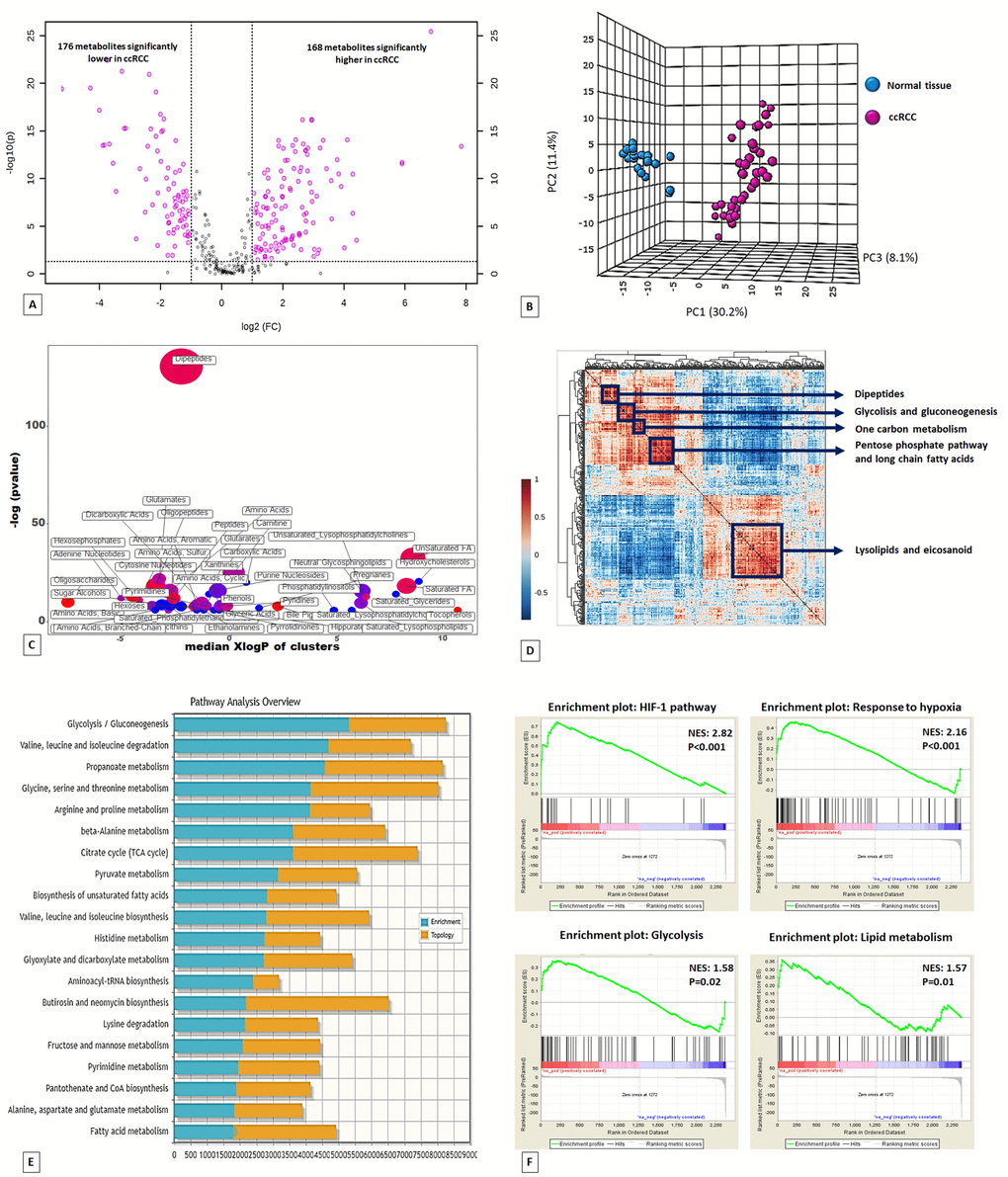 Volcano plot of the 516 metabolites profiled. 344 exhibited significant differential abundance when comparing ccRCC to normal kidney tissues (A). Principal component analysis (PCA) of global tissue metabolome demonstrated that the two groups (ccRCC vs normal renal tissue) were clearly distinguishable (B). ChemRICH set enrichment statistical plot. Each node reflects a significantly altered cluster of metabolites. Node sizes represent the total number of metabolites in each cluster set. The node color scale shows the proportion of increased (red) or decreased (blue) compounds in tumor compared to normal tissue. Purple color nodes have both increased and decreased metabolites (C). Hierarchical cluster analysis and heatmap of metabolite-metabolite correlation matrix. Metabolite clusters are indicated (D). Integrated metabolic pathway enrichment analysis. The stacked bars show a summary of the joint evidence from enrichment and topology analyses (E).Gene Set Enrichment Analysis (GSEA) of the GSE47032 dataset (F).