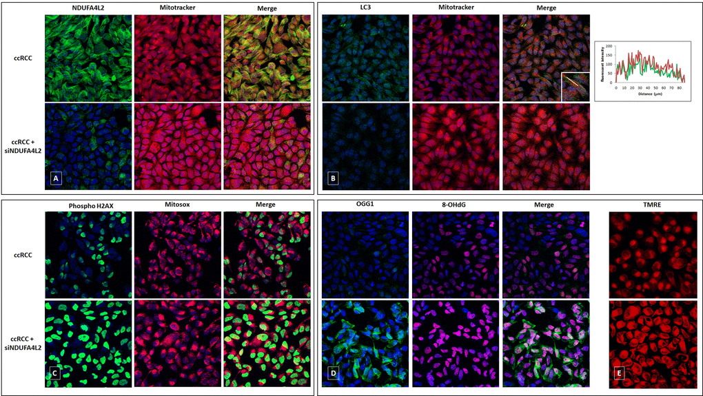 Immunofluorescence showing the increase in MitoTracker signal levels in ccRCC cells treated with small interfering RNA targeting NDUFA4L2 (siNDUFA4L2) compared to untreated cells (A). The autophagic marker LC3 is increased in ccRCC cells and co-localizes with the mitochondrial label MitoTracker. A line profile is shown (B). NDUFA4L2-silenced cancer cells show an increased superoxide radicals production (C), high levels of phospho-H2AX (C), a significant accumulation of 8-oxodG (D), and a reactive increased expression of the DNA repair enzyme OGG1 (D). NDUFA4L2 silencing increased the membrane potential in cancer cells, as shown by increased signals of the fluorescence probe TMRE (E).