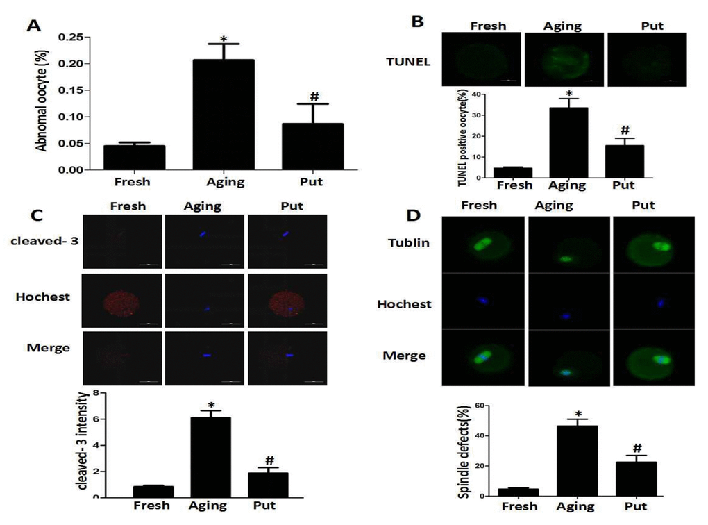 Putrescine decreased the apoptosis index and alleviated morphological changes during the postovulatory aging of oocytes. (A) The morphological defects of oocytes during the postovulatory aging process. The proportion of abnormal oocytes was increased in the oocytes undergoing postovulatory aging. When the MII oocytes were exposed to 0.5 mM of putrescine, the rate of morphological defects was significantly lowered when compared with the aging oocytes. (B) The level of apoptosis in the oocytes during postovulatory aging. TUNEL analysis confirmed the increased apoptosis during the postovulatory aging of oocytes. The apoptosis was significantly inhibited by the 0.5 mM of putrescine that was added to the in vitro culture medium. (C) The activated caspase 3 showed the increased level of apoptosis in the oocytes during postovulatory aging. The level of cleaved caspase 3 was significantly increased in the aging oocytes. Putrescine significantly inhibited the activation of caspase 3 in the aging oocytes. (D) The morphological observation of spindles. In the aging oocytes, the spindles became elongated, the microtubules were gradually lost from the spindle, and the aberrant chromosomal alignment was increased. The proportion of abnormal spindles was significantly decreased in the putrescine-treated group. Put, putrescine. Compared with the fresh MII oocytes, *pp