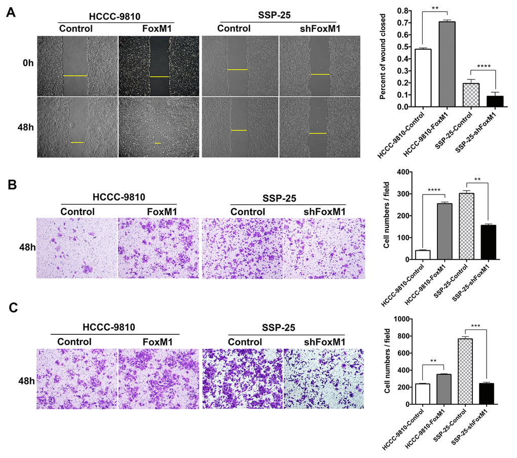 FoxM1 promoted the migration and invasion of ICC cells in vitro. The motility of ICC cells was detected by scratch assays (A) and Transwell migration assays (B). The invasiveness of ICC cells was determined by Transwell invasion assays (C). Statistics are shown with a bar graph. **P ***P ****P 