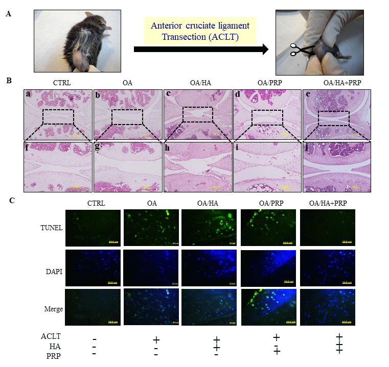 TUNEL labeling of anterior cruciate ligament transection (ACLT) induced osteoarthritic right knee of 8-months old female C57BL/6J mice. (A) The anterior cruciate ligament of knee-joint was removed through surgical knife and OA was established after 1 month. The HA, PRP, and HA+PRP were injected into right knee after establishment of ACLT-OA for one month. After sacrifice, the right knees biopsies were collected for TUNEL assay to detect cellular apoptosis. (B) Histologic hemotoxylin and eosin (H&E)-stained sections revealing ultrastructural architecture of articular cartilage in knee joint of control, OA, HA, PRP and HA+PRP group. The upper panel (a-e, respectively) represent lower magnification (500µm). The dotted rectangular areas in lower magnification images are shown as higher magnification (200 µm) (f-j, respectively). (C) Representative images of TUNEL staining in the knee joint after cartilage green staining indicating TUNEL positive (apoptotic) cells against a DAPI (blue) nuclear counter stain.