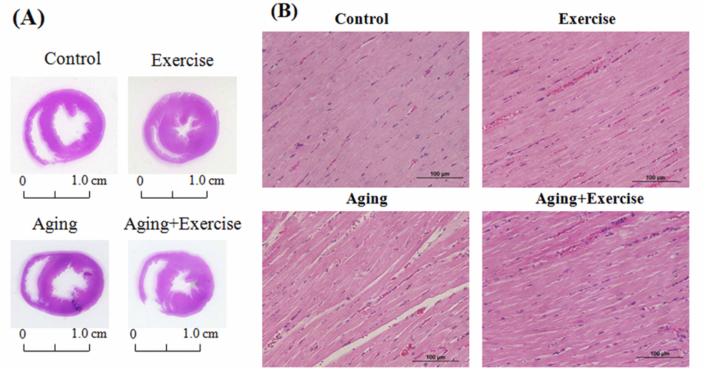 Hematoxylin and eosin stain (H&E stain) showing the cardiac tissue architecture. Representative histopathological analysis of cardiac sections of the left ventricles stained with hematoxylin and eosin. The hematoxylin colors basophilic structures blue-purple and the eosin colors eosinophilic structures in bright pink. The images of myocardial architecture were magnified at 400X.