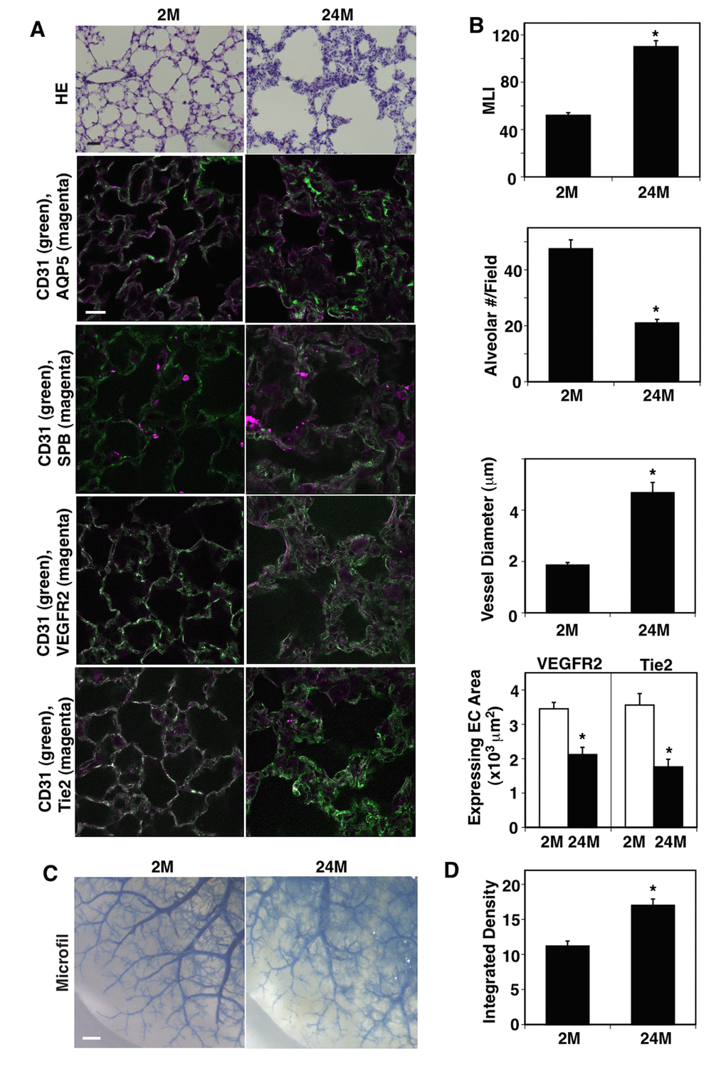 Age-dependent changes in vascular and alveolar structures in the mouse lungs. (A) H&E-stained 2M and 24M old mouse lungs (top, scale bar, 20 μm). Immunofluorescence micrographs showing CD31-positive blood vessels and AQP5-positive alveolar type-I epithelial cells (2nd), CD31-positive blood vessels and SPB-positive alveolar type-II epithelial cells (3rd), CD31-positive blood vessels and VEGFR2 expression (4th), and CD31-positive blood vessels and Tie2 expression (bottom) in the 2M vs. 24M old mouse lungs (scale bar, 20 μm). (B) Graphs showing quantification of alveolar size (MLI, top), alveolar number (2nd), vessel diameter (3rd), and area of ECs expressing VEGFR2 and Tie2 (bottom) in the 2M and 24M old mouse lungs (n=7, mean ± s.e.m., *, pC) Micrographs showing blood vessel structures in the 2M and 24M old mouse lungs analyzed using the Microfil casting system. Scale bar, 1 mm. (D) Graph showing the quantification of casting reagent leaked out of the lung blood vessels (n=7, mean±s.e.m., *p