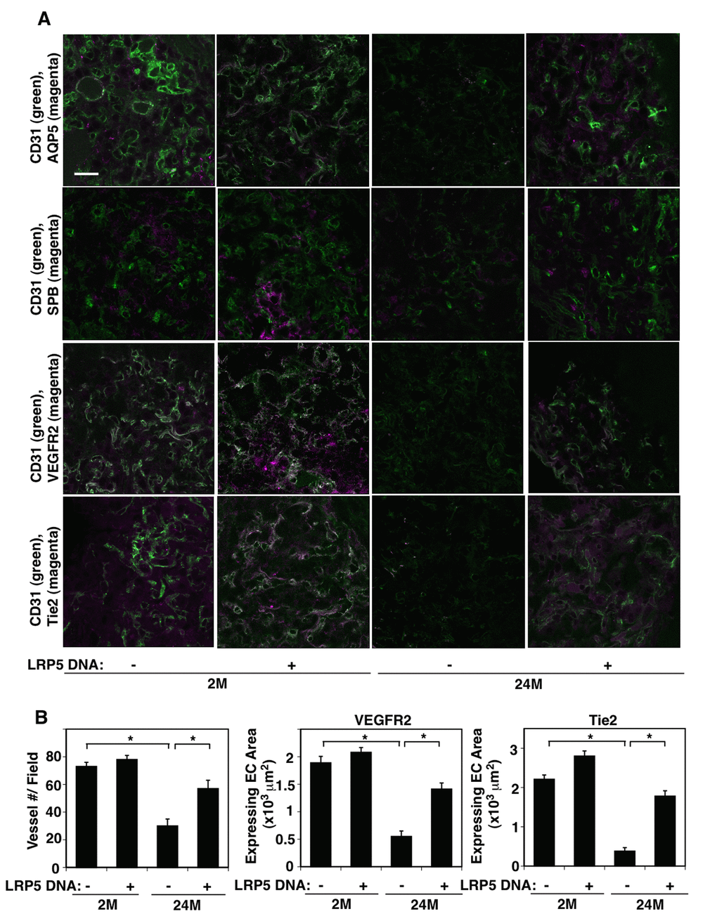 LRP5 mediates age-dependent decline in vascular and alveolar epithelial morphogenesis in the gel implanted on the mouse lungs. (A) Immunofluorescence micrographs showing CD31-positive blood vessels and AQP5-positive alveolar type-I epithelial cells (top), CD31-positive blood vessels and SPB-positive alveolar type-II epithelial cells (2nd), CD31-positive blood vessels and VEGFR2 expression (3rd), and CD31-positive blood vessels and Tie2 expression (bottom) in the fibrin gel implanted on the 2M vs. 24M old mouse lungs or in combination with LRP5 overexpression for 7 days (scale bar, 20 μm). (B) Graphs showing quantification of CD31-positive blood vessel numbers (left), area of ECs expressing VEGFR2 (middle) and Tie2 (right) in the gel implanted on the 2M vs. 24M old mouse lungs or in combination with LRP5 overexpression for 7 days (n=7, mean ± s.e.m., *, p