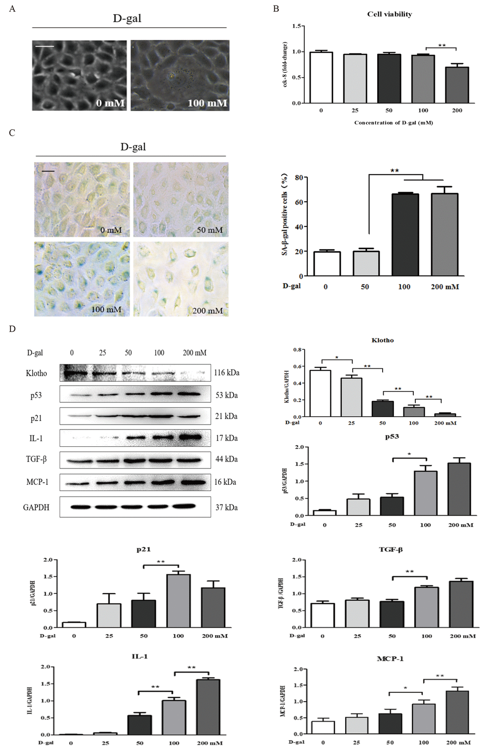 The characteristics of renal cellular aging and injuryinduced by D-galactose in vitro. (A) The morphological changes in the NRK-52E cells with or without 100 mM D-gal treatment for 24 hours by light microscope. (B) The cell viability in the NRK-52E cells exposed to D-gal at 0, 25, 50, 100, and 200 mM for 24 hours. (C) SA-β-gal staining in the NRK-52E cells exposed to D-gal at 0, 50, 100, and 200 mM for 24 hours, and the percentage of SA-β-gal-positive cells. (D) The NRK-52E cells were treated with D-gal at 0, 25, 50, 100, and 200 mM for 24 hours, and subjected to a WB analysis of klotho, p53, p21, IL-1, TGF-β and MCP-1. The data are expressed as the mean ± SD, (n=3), *P **P 