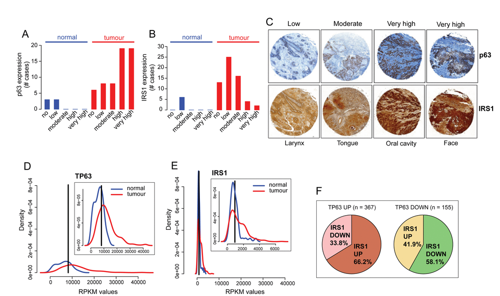 p63 and IRS1 expression patterns are positively correlated in HNSCC patients. (A-C) Tissue sections were stained with anti-p63 and IRS1 antibodies. The scores for the percentage of p63 and IRS1 positive cells and those for the expression intensities were combined to calculate immunoreactive scores (IRSs) summarised in Table S1. According to the IRS, patients were assigned to five groups: 0 (no expression), 0,5 (low expression), 1 (moderate expression), 1,5-2 (high expression), and 2,5-3 (very high expression). The distribution of p63 and IRS1 expression in HNSCC specimens and normal tissues is shown in A, B. (C) Representative micrographs of immunohistochemical staining of p63 and IRS1 in HNSCC primary tumours (magnification: 40x). (D-E) Density distribution of RPKM values in normal (n=44; blue) and tumour (n=522: red) samples for p63 and IRS1 transcripts. Top right panels show an enlargement of the overlapping curves. Vertical black line indicates the optimal cutpoint between tumour and normal RPKM distributions, identified using OptimalCutpoints R package [96] P-value P-value F) Pie charts representing the proportion of tumour samples with IRS1 up- or down-regulated in p63 up (left) and p63 down-regulated (right) tumour samples. Statistical significance of the contingency table represented by the 4 sub-dataset of tumour samples is p-value= 4.293e-07 (Fisher’s exact test). Statistical tests (Wilcoxon and Fisher’s exact tests) on TCGA gene expression data were performed in R.