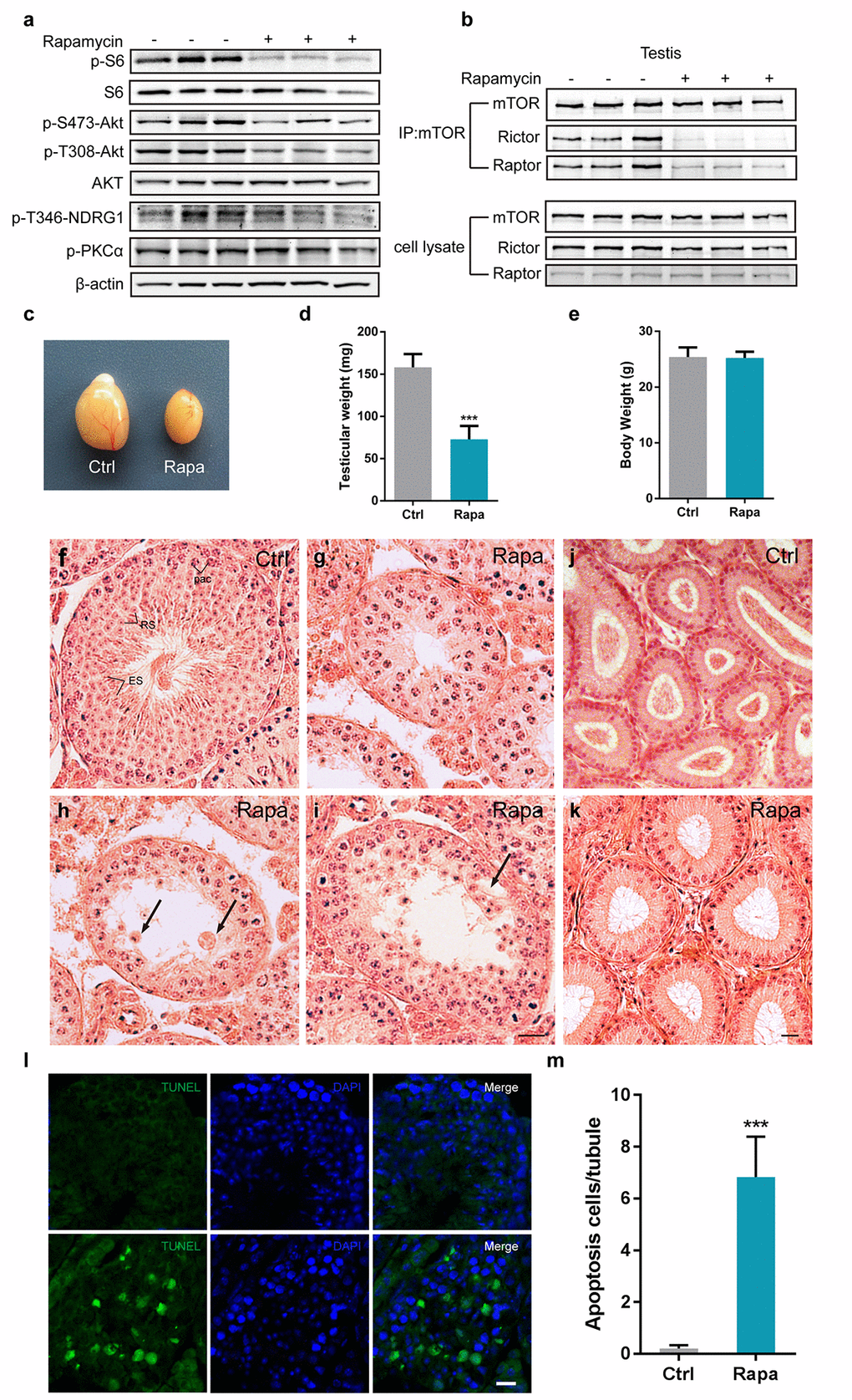 Chronic rapamycin treatment disrupts spermatogenesis in male mice and inhibits assembly of mTOR complexes. Tissues from adult males were analyzed after weeks of daily i.p. injection with rapamycin or vehicle control beginning at age 7-8 weeks. (a) Western blot analysis of phosphorylated S6, AKT, PKCα, and the SGK substrate NDRG1 in testicular extracts from adult males (control, n=3; rapamycin, n=3). (b) Chronic rapamycin treatment impairs mTOR complex integrity and activity. Immunoblotting of mTOR immunoprecipitates from testis tissue from adult males (control, n=3; rapamycin, n=3). (c) Gross morphology of testis tissue from control or rapamycin (rapa) treated males. (d) Testis weight (control, n=5; rapamycin, n=4). Error bars represent SD (***P e) Body weight (control, n=5; rapamycin, n=4). (f-i) Testis histology. Hematoxylin/eosin stained representative testis sections. Scale bar,20μm.(f) Seminiferous tubule from control testis, containing pachytene spermatocytes (Pac), round spermatids(RS), and elongating spermatids (ES), indicating normal spermatogenesis. (g) Seminiferous tubule from rapamycin-treated testis with meiotic arrest at the pachytene stage. (h) Seminiferous tubule from rapamycin-treated testis with clusters of aggregated round spermatids. Black arrow indicates multinucleated cells. (i) Rapamycin-treated tubules with large vacuoles in the seminiferous epithelium. Black arrowhead points to vacuoles. (j, k) Histological analysis of epididymis from adult control and rapamycin-treated mice. (l) TUNEL staining of testis sections from control and rapamycin-treated mice. Scale bar, 20μm. (m) Quantification of TUNEL-positive cells per tubule. Error bars represent SD (**P 