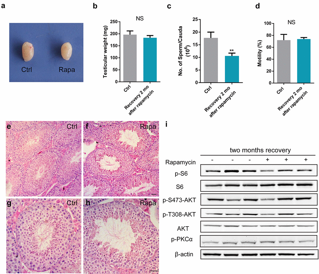 Rapamycin causes a reversible effect on spermatogenesis. All panels show samples from adult males injected with vehicle control (ctrl-rec, n=3) or rapamycin for 3 weeks (rapa-rec, n=3), followed by a recovery period of 2-months. (a) Gross testis morphology. (b-d) Testis mass (b), sperm count (c), and sperm motility (d). Data represent the mean ±SD (NS, not significant, **Pe-h) Testis histology reveals full spectrum of spermatogenesis at 2 months after rapamycin treatment cessation. (i) Western blot analysis of phosphorylation of mTORC1 and mTORC2 substrates.