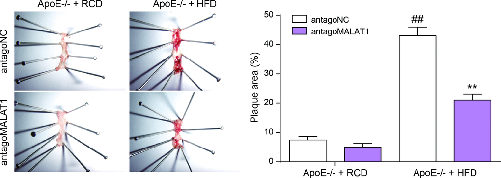 En face analysis of thoracoabdominal aorta and cross-sections of the root of aorta. The atherosclerotic lesions throughout the aorta in ApoE−/− mice were lessened in the antagoMALAT1 group and the plaque area in ApoE−/− +HFD group was larger than that in ApoE−/− +RCD group. **PP