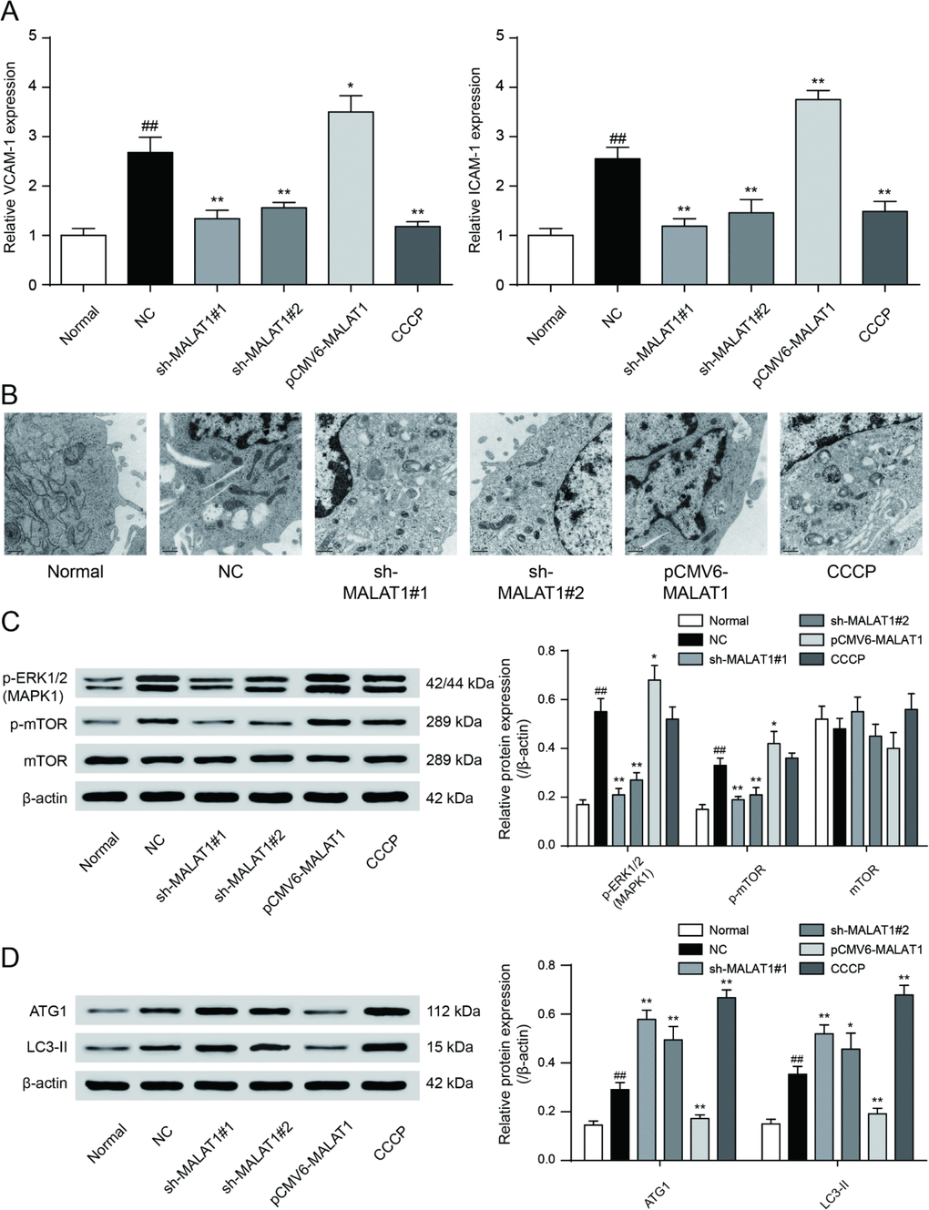 VCAM-1/ICAM-1 expression and mTOR signaling pathway expression in cells. (A) QRT-PCR results exhibited that sh-MALAT1#1, sh-MALAT1#2 and CCCP suppressed VCAM-1 and ICAM-1 expression and there was conspicuous difference between normal group and NC group, knockdown of MALAT1 could inhibit CAD progress effectively. *PPPB) Transmission electron microscope showed the autophagosome in sh-MALAT1#1 or, sh-MALAT1#2 and CCCP group was more than in NC group. (C) mTOR signaling pathway expression in different transfection groups. *PPPD) ATG1 and LC3-II expression level in different transfection groups. PPP