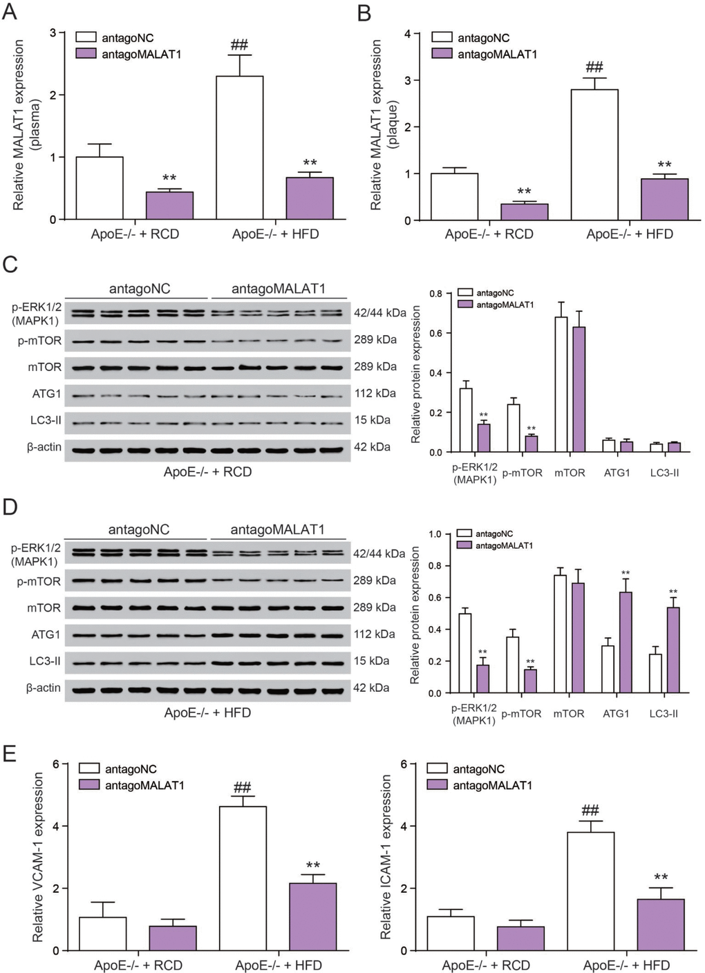 AntgoMALAT1 protects mice against atherosclerosis. (A, B) The expression of MALAT1 was determined by qRT-PCR in plasma and aortic tissue from ApoE−/− +RCD and ApoE−/− +HFD mice which were injected with antagoMALAT1 or antagoNC, n=5. **PPC) Western blot result of MAPK1, phosphorylated mTOR, mTOR and autophagy related protein ATG1 and LC3-II in ApoE−/− +RCD group. **PD) Western blot result of MAPK1, phosphorylated mTOR, mTOR and autophagy related protein ATG1 and LC3-II in ApoE−/− +HFD group. **PE) QRT-PCR results of VCAM-1/ICAM-1 expression with the different treatment in ApoE−/− +RCD and ApoE−/− +HFD groups. **PP