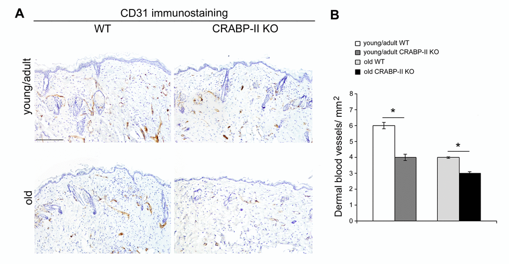 Dermal blood vessels are reduced in CRABP-IIknock-out mice. (A) Representative images and (B) bar graph showing semiquantitative evaluation of CD31-positive dermal small vessels in young/adult and old wild-type (WT) and CRABP-II knock-out (KO) mice (n=10 young/adult and n=10 old WT, n=10 young/adult and n=10 old CRABP-II KO). Scale bar: 100µm. Values are group mean ± SEM. t-Test: * indicates p