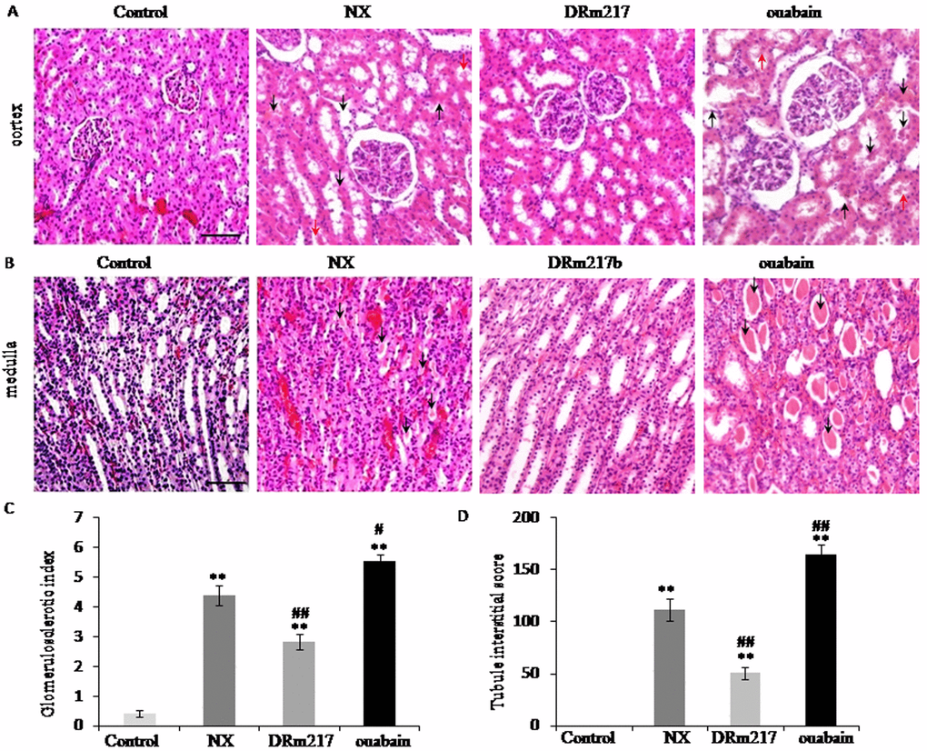 DRm217 alleviated but ouabain strengthened kidney morphological damage. (A) Represent images of HE staining for renal cortex. Representative photomicrographs of glomerulosclerosis, tubular dilation and degeneration (black arrow), and protein deposition (red arrow) were observed. (B) Represent images of HE staining for renal medulla. Representative photomicrographs of muddy brown casts (black arrow) were observed. (C) Calculated results of glomerulosclerotic index. (D) Calculated results of Tubule interstitial score. n=6-8. Means±SEM; *** pppp