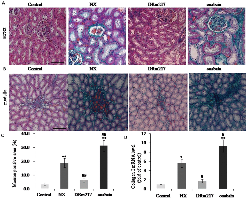 DRm217 attenuated but ouabain strengthened renal fibrosis. (A) Represent images of Masson staining for renal cortex. (B) Represent images of Masson staining for renal medulla. (C) Quantitative analysis of Masson-staining area. (D) RT-qPCR analysis of mRNA levels of Collagen I. n=6-8. Means±SEM; * p, **ppp