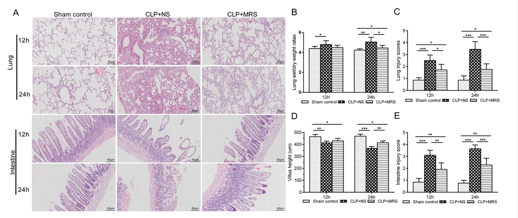 Methane-rich saline alleviated the histopathology damage and organ dysfunction induced by sepsis. The lung and intestine tissues were collected 12 and 24 h after the cecal ligation and puncture (CLP) operation. (A) Representative hematoxylin and eosin (H&E) staining of lung and intestine sections (Scale bars: 50μm). (B) The lung wet/dry weight ratio was calculated as an assessment of lung injury. (C) Lung injury scores. (D) The villus height was measured as an assessment of intestine injury. (E) Intestine injury scores. (n = 12. Data are shown as the mean ± SD. *P  **p ***P 