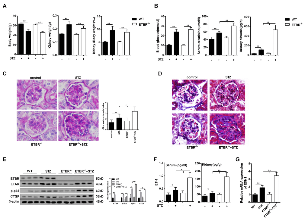 Severer diabetic nephropathy in ETBR-/- mice. (A) Body weight and kidney weight were detected in control mice (WT), STZ-diabetic mice, ETBR-/- mice and STZ-diabetic ETBR-/- mice. **pB) Serum glucose level, serum creatinine level and urinary albumin level were measure in control mice (WT), STZ-diabetic mice, ETBR-/- mice and STZ-diabetic ETBR-/- mice. **pC) Periodic acid-Schiff (PAS) staining of kidney tissues from control mice, STZ-diabetic WT mice, ETBR-/- mice, and STZ-diabetic ETBR-/- mice. **p-/- mice. 1000×magnification. (D) MASSON staining of of kidney tissues from control mice, STZ-diabetic WT mice, ETBR-/- mice, and STZ-diabetic ETBR-/- mice. 1000×magnification. (E) Protein levels of ECM-related protein CTGF and p-p65 in control mice, STZ-diabetic WT mice, ETBR-/- mice, and STZ-diabetic ETBR-/- mice. *p-/-, or STZ mice. **p-/-, or STZ mice. N=3. (F-G) Serum ET-1/kidney ET-1 expressions and transcriptional level of EDN1 from kidney were detected in control mice, STZ-diabetic WT mice, ETBR-/- mice, and STZ-diabetic ETBR-/- mice. *p-/-, or STZ mice. Bars depict the mean ± SD. N=5.