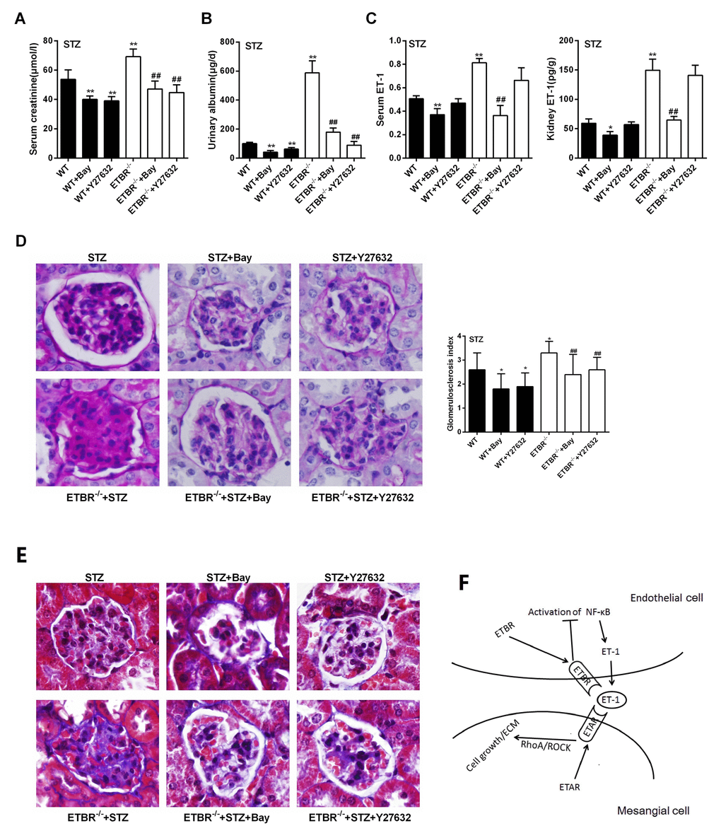 Inhibition of NF-kappaB pathway ameliorated DN in ETBR-/- mice in vivo. (A-C) C57BL/6 mice, ETBR-/- mice were intraperitoneally injected with 50 mg/kg STZ every day for five days to establish STZ-diabetic mice model. Bay (1 mg/kg, Bay 11-7082) was dissolved in normal saline, and injected intraperitoneally twice a week between seventh and tenth weeks after STZ treatment. Y27632 (5 mg/kg, Rhoa/Rock inhibitor) was injected intraperitoneally twice a week between seventh and tenth weeks after STZ treatment. Serum creatinine, urinary albumin, serum ET-1 and kidney ET-1 were detected in WT, WT+Bay, WT+Y27632, ETBR-/-, ETBR-/-+Bay and ETBR-/-+Y27632 mice groups. **p-/-. Bars depict the mean ± SD. N=6. (D) PAS staining showed that enlargement of glomeruli was observed in STZ-diabetic mice, and glomerulosclerosis was relieved in Bay and Y27632 treated WT or ETBR-/- mice. **p-/-. 1000×magnification. (E) MASSON staining showed that collagen was produced in glomeruli in STZ-diabetic mice, and the formation of collagen was relieved in Bay and Y27632 treated WT or ETBR-/- mice. 1000×magnification. (F) Cascade diagram of signaling pathways.